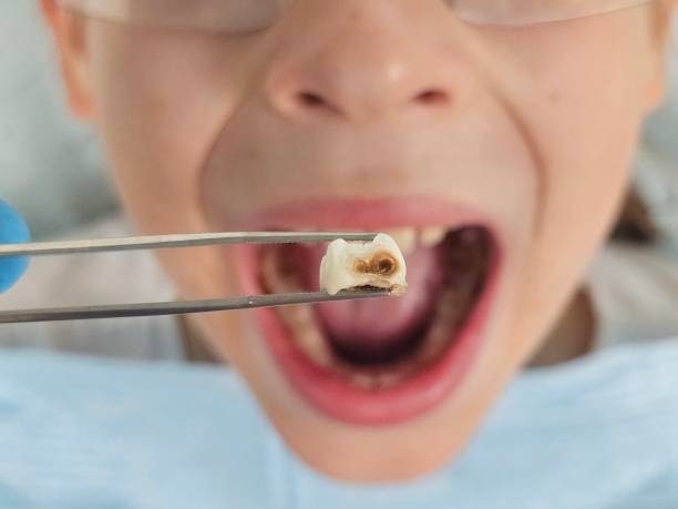 Best Mobile Emergency Dentist in Shell Lake, WI
